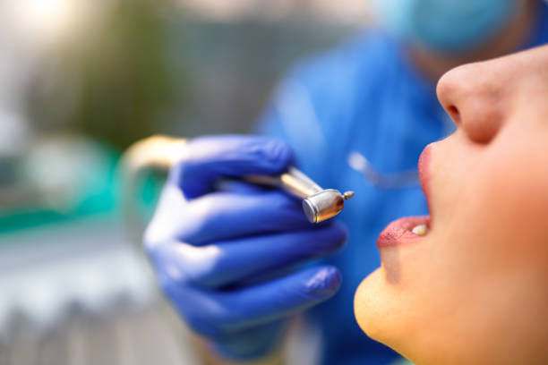 Best Wisdom Tooth Removal  in Schriever, LA
